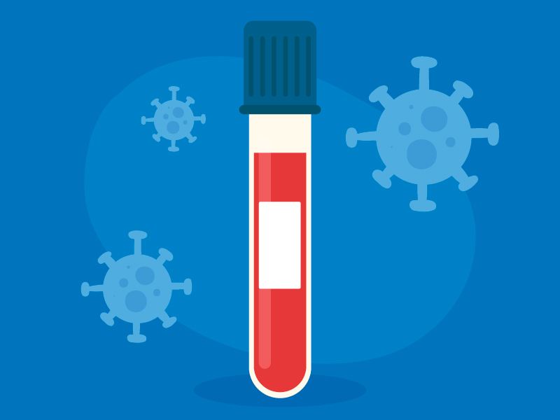 Главное оружие против эпидемии: зачем нужны тесты на коронавирус